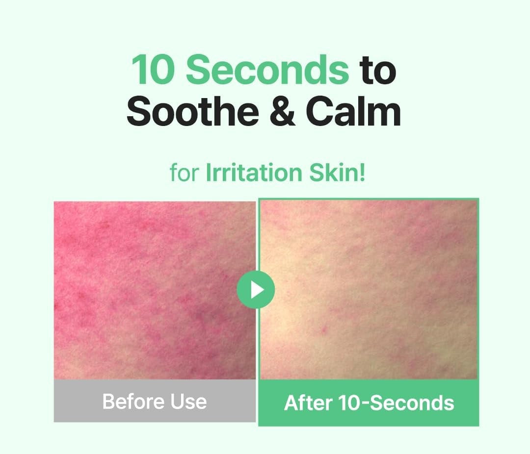 Dream Pure Naturals Acne Clarifying Treatment Face Serum